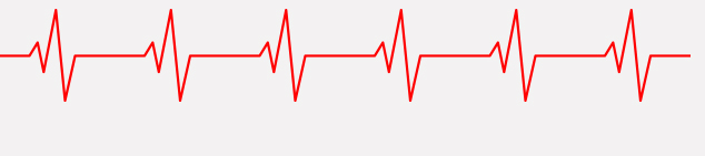 pulse