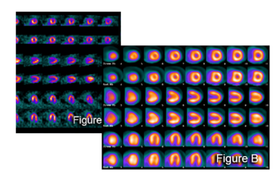 Cardiac PET/CT Imaging Solutions | Molecular Imaging Services