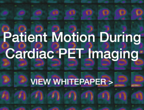 Patient Motion During Cardiac PET Imaging
