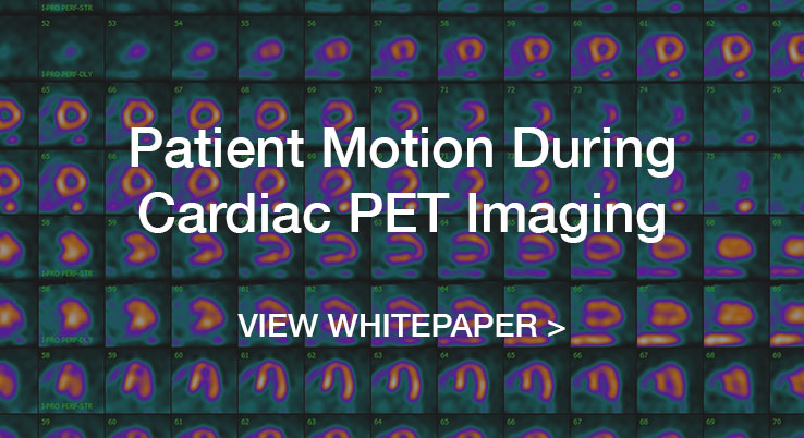 Patient Motion During Cardiac PET Imaging