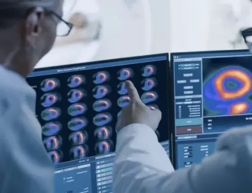 ASNC says PET is now the preferred nuclear imaging test for CAD