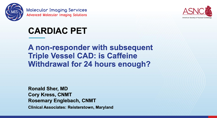 A Non-Responder with Subsequent Triple-Vessel CAD: Is 24 Hours of Caffeine Withdrawal Enough?