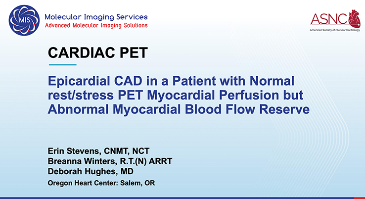 Epicardial CAD in a Patient with Normal Rest/Stress PET Perfusion but Abnormal Myocardial Blood Flow Reserve