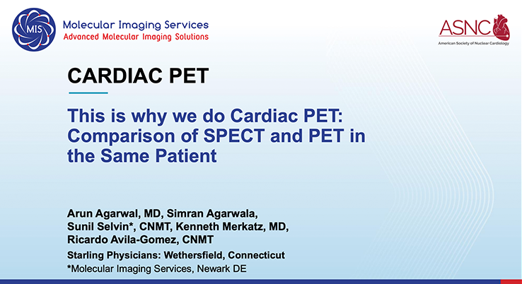This Is Why We Do Cardiac PET: Comparison of SPECT and PET in the Same Patient